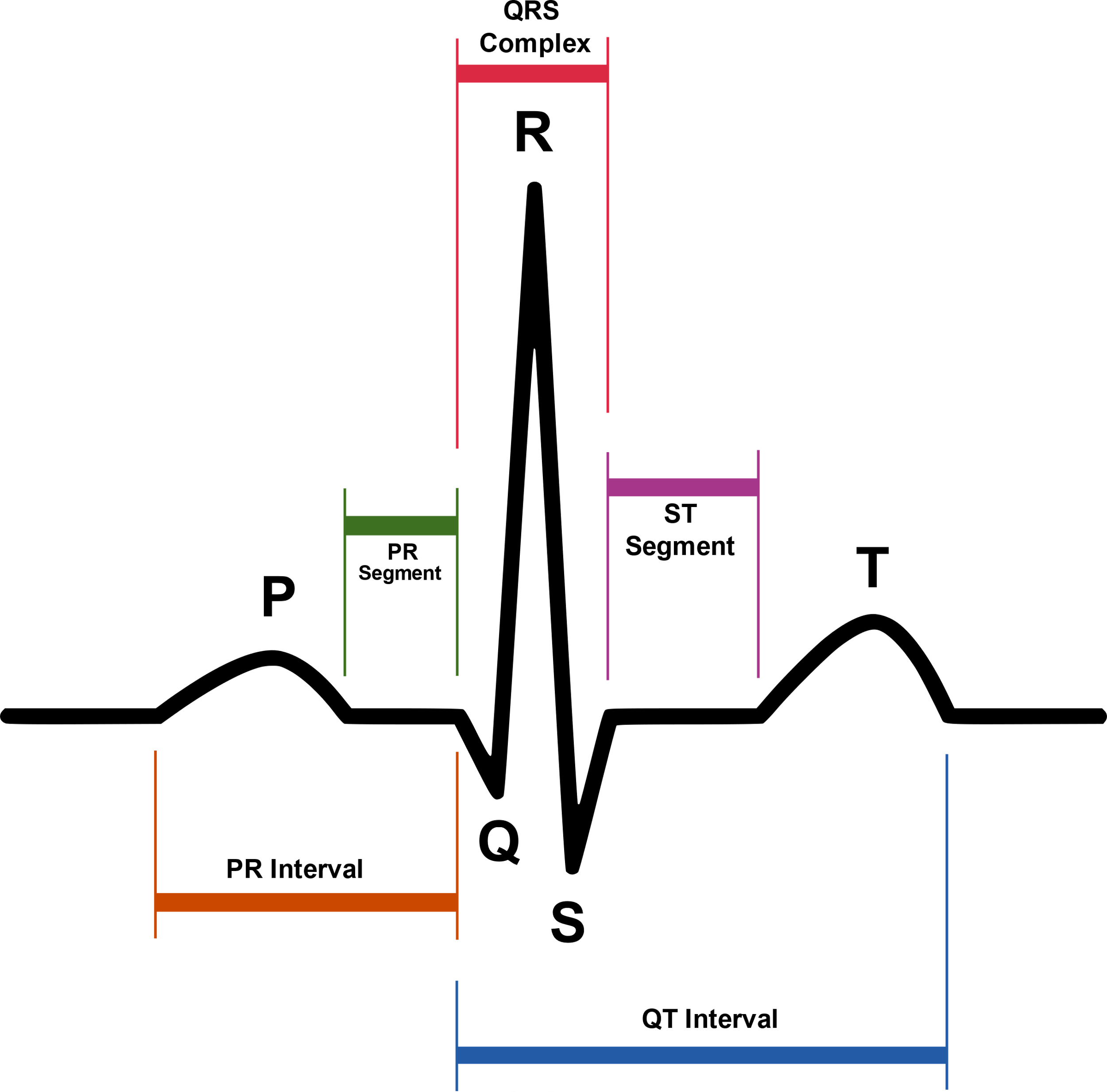 Waveform Explanation